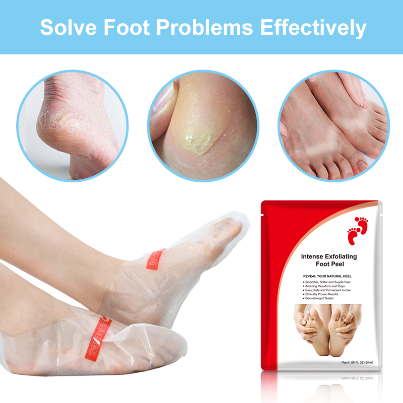 Maschera peeling per i piedi rimuovi-callosità con acido glicolico - 5